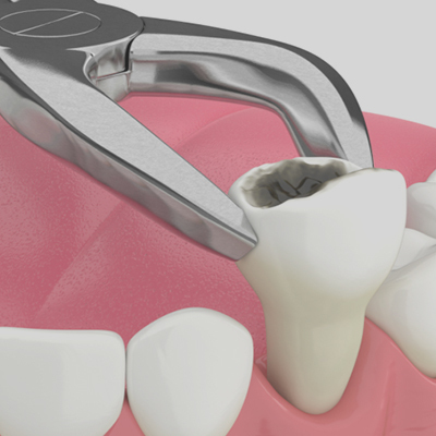 General Dentistry