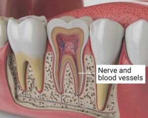 Tooth Nerve Pain Relief Therapy in the Bronx, NY